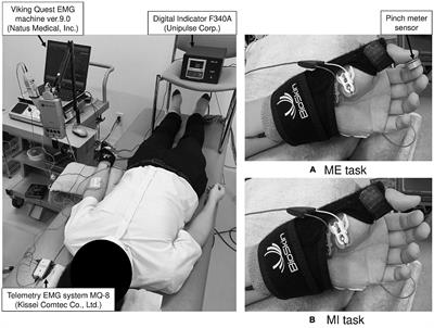 Thenar Muscle Motor Imagery Increases Spinal Motor Neuron Excitability of the Abductor Digiti Minimi Muscle